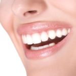 professional_teeth_whitening_McMinnville_dentist