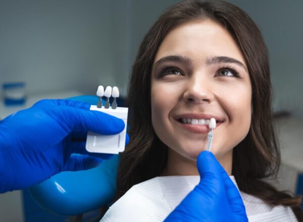 What Are Veneers And How You Should Care For Them?