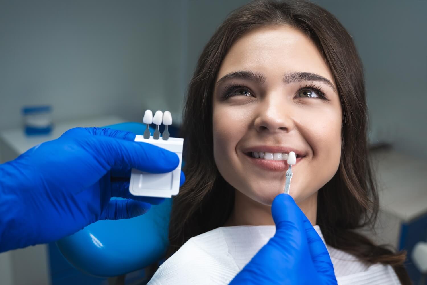 What Are Veneers And How You Should Care For Them?